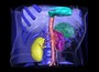Abdomen with segmented organs and Texture3D volume viusalization